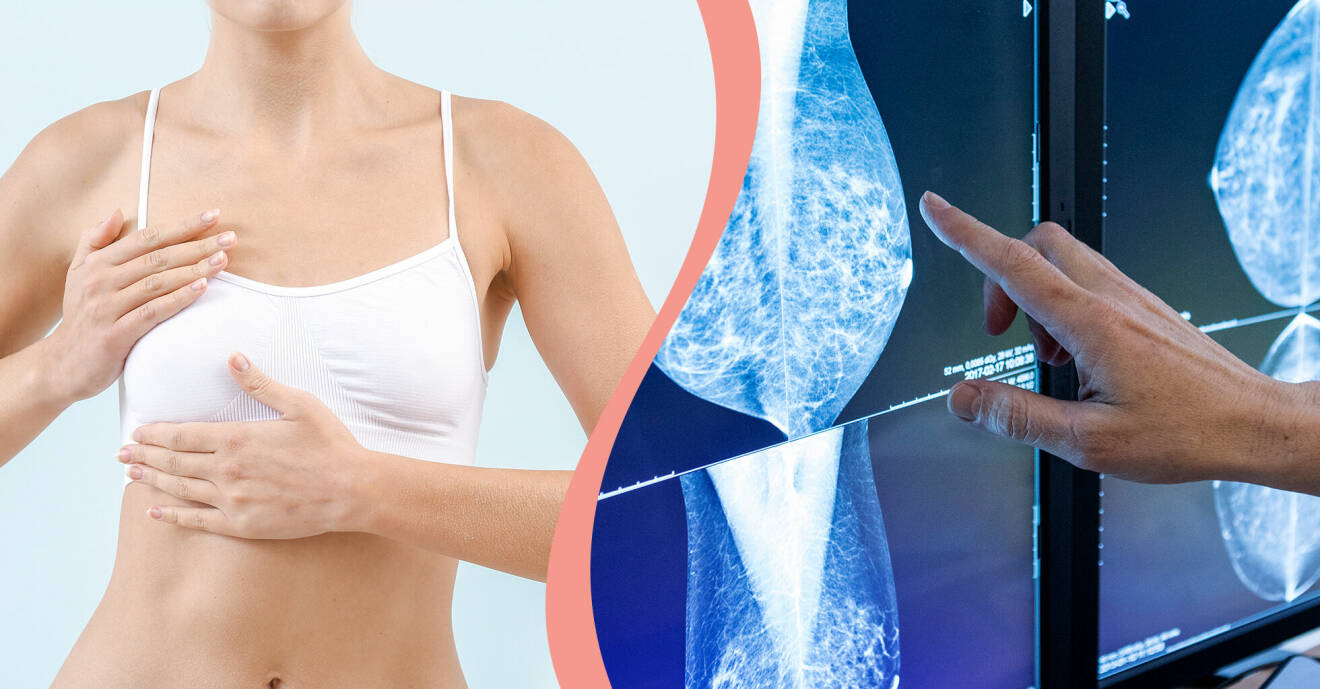 Till vänster, kvinna känner på ena bröstet, till höger, en röntgenläkare tittar på bilder.