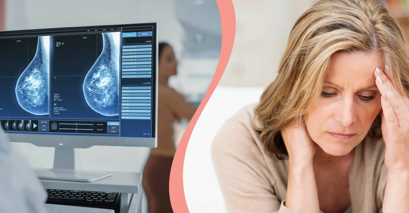Till vänster mammografibild, till höger en oroad kvinna.