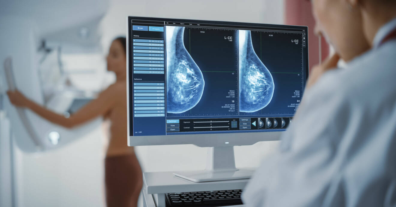 Läkare undersöker bröst mammografiscreening.