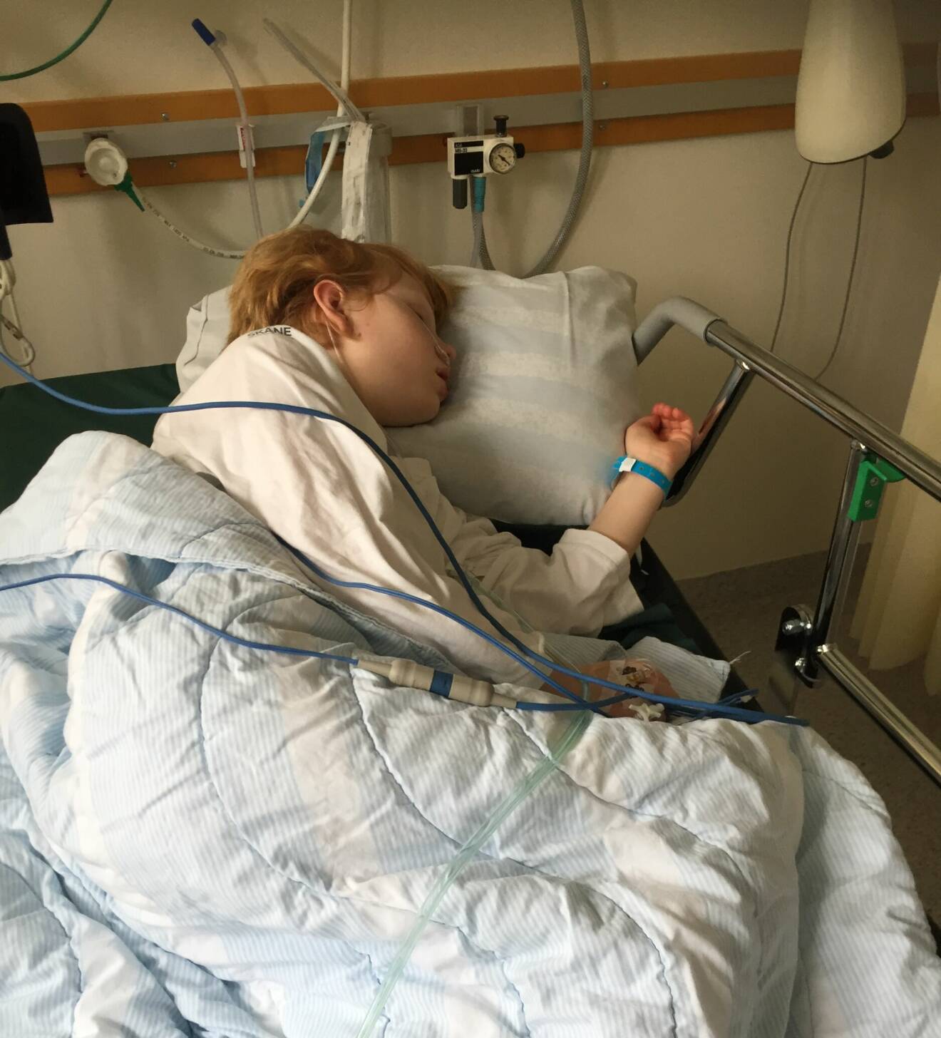 Nora Nilsson sover i sjukhussängen efter att ha blivit sövd i samband med en gastroskopi.