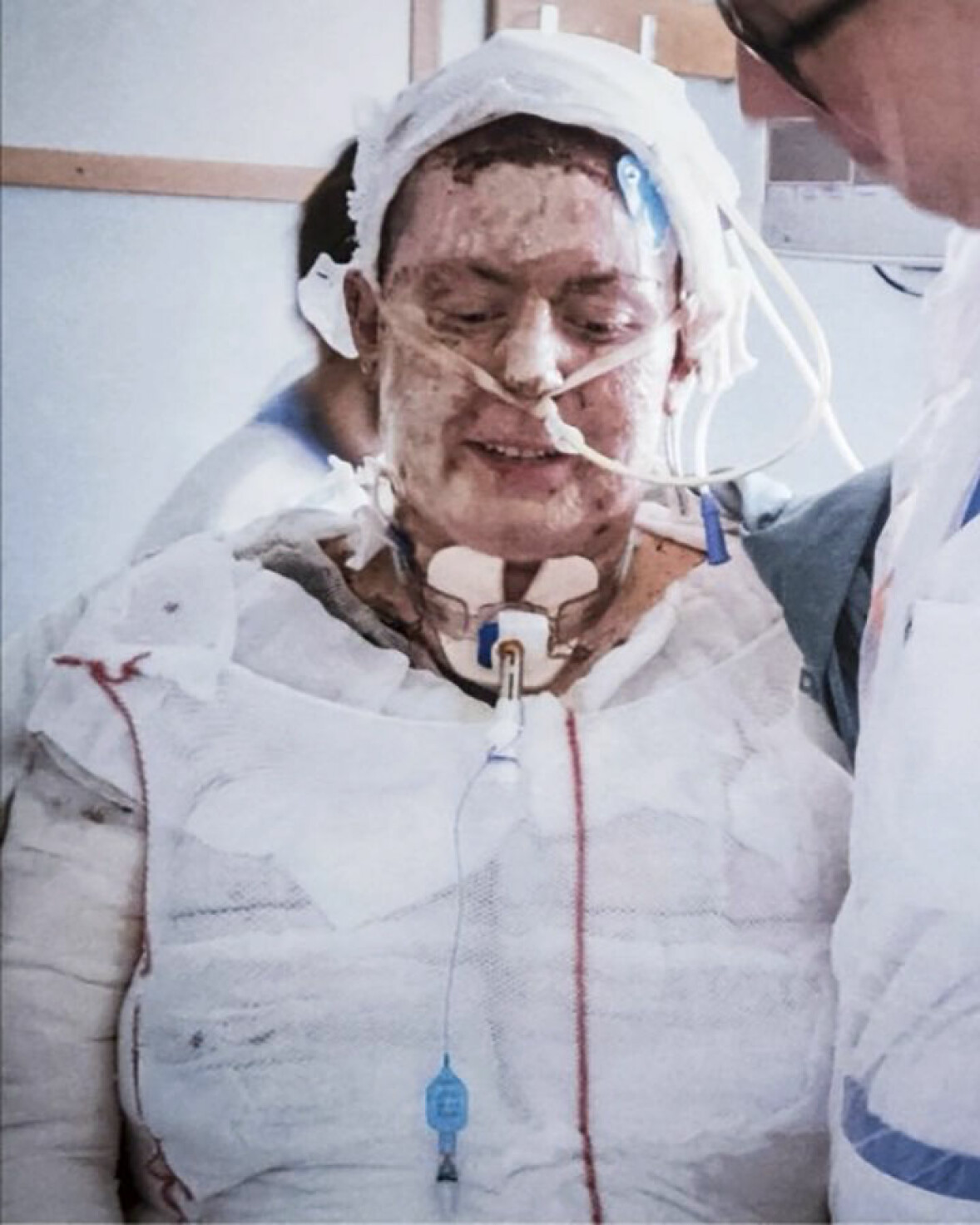 "Grannen samlade barnen och jag frågade gång på gång om jag fått ut alla och trots att de konstaterade att alla barn var räddade upprepade jag frågan". Emma Schols hud var full av blåsor – om den ens satt kvar på kroppen – efter branden som slukade hennes hus.