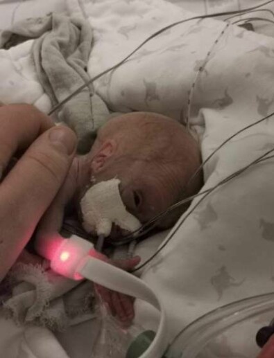 Luna har haft änglavakt som har klarat sig så bra. Foto: Privat En för tidigt född liten flicka ligger med syrgasslangar i näsan i en sjukhussäng.