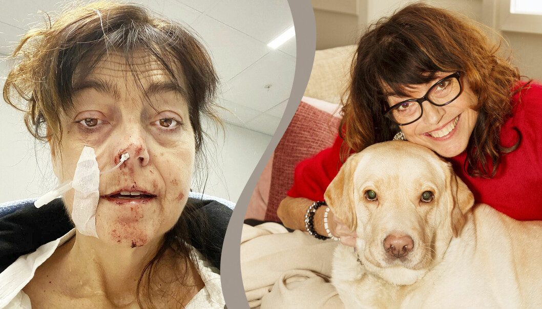 Kvinna som fick covid-19 och blev jättesjuk, med sin hund.
