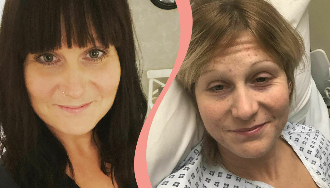 Delad bild. Till höger Karin Eriksson i sjukhussängen efter att ha gått igenom en operation för sin endometrios. Till vänster en nytagen bild av Karin.