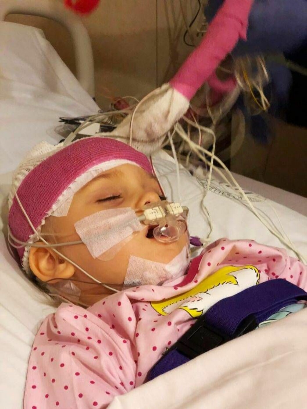 Liv föddes sex veckor för tidigt. När Liv var spädbarn upptäckte hennes föräldrar att hon inte utvecklades enligt sin ålder. Foto: Privat Liv, 4 kan varken tala, gå eller stå
