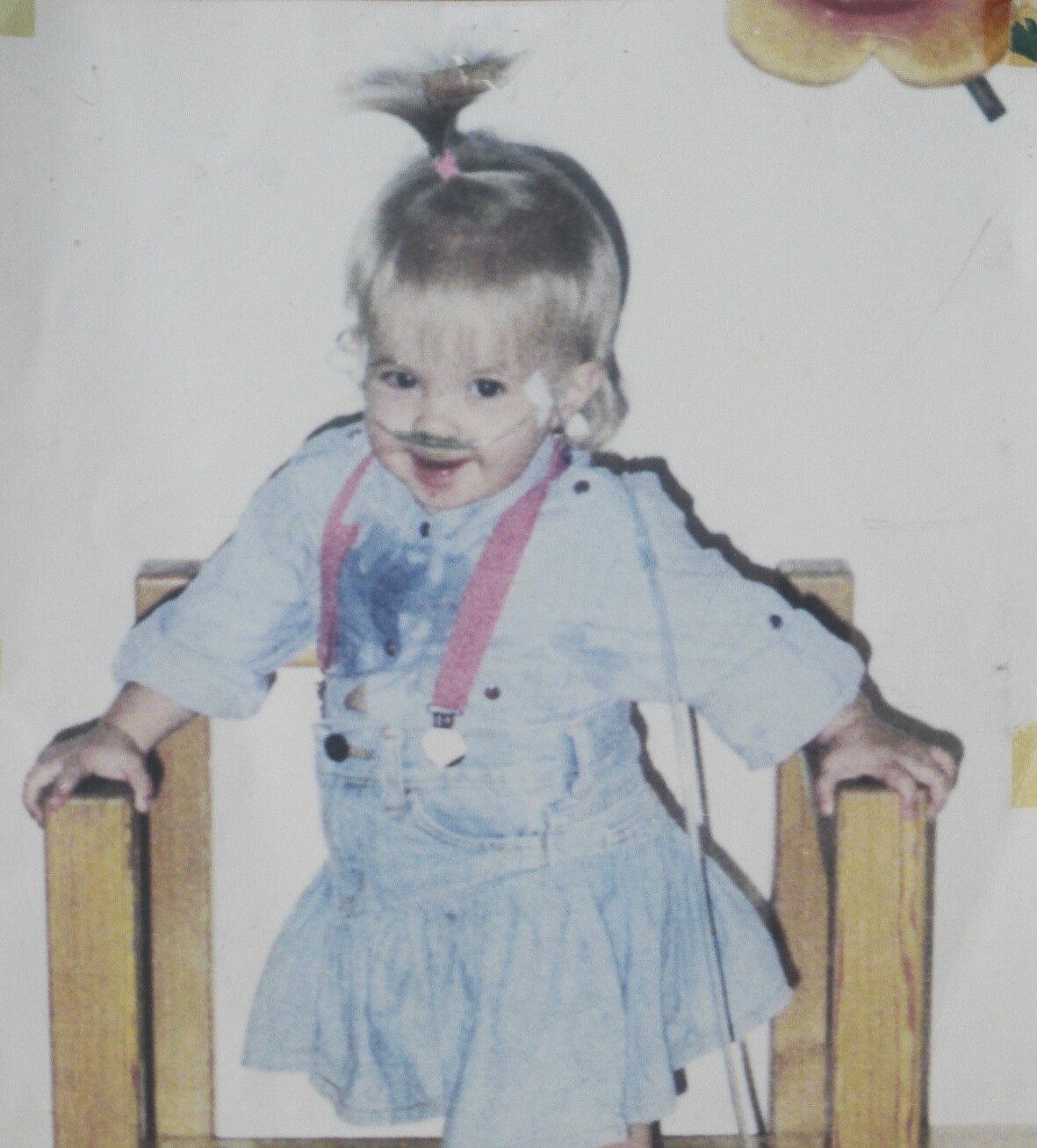 Som liten hade Madelen problem med lungorna, läkarna trodde inte att hon skulle överleva. En glad liten flicka med näsgrimma på grund av lungproblem.