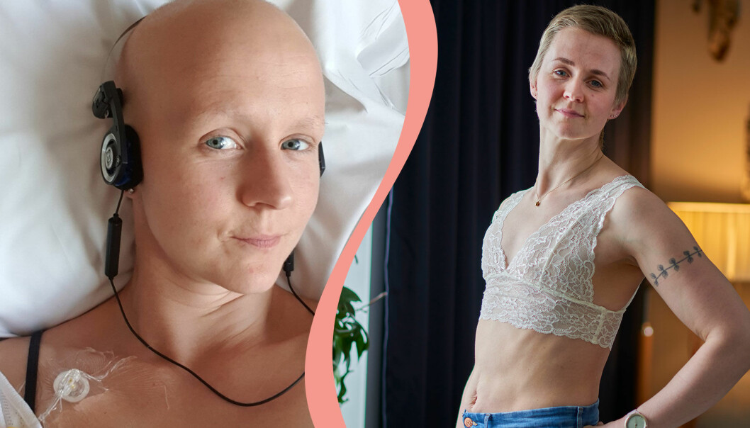 Matilda Lindmark fick kämpa för rätten att bli platt efter bröstcanceroperationen och är nu en av grundarna till föreningen Plattnormen.