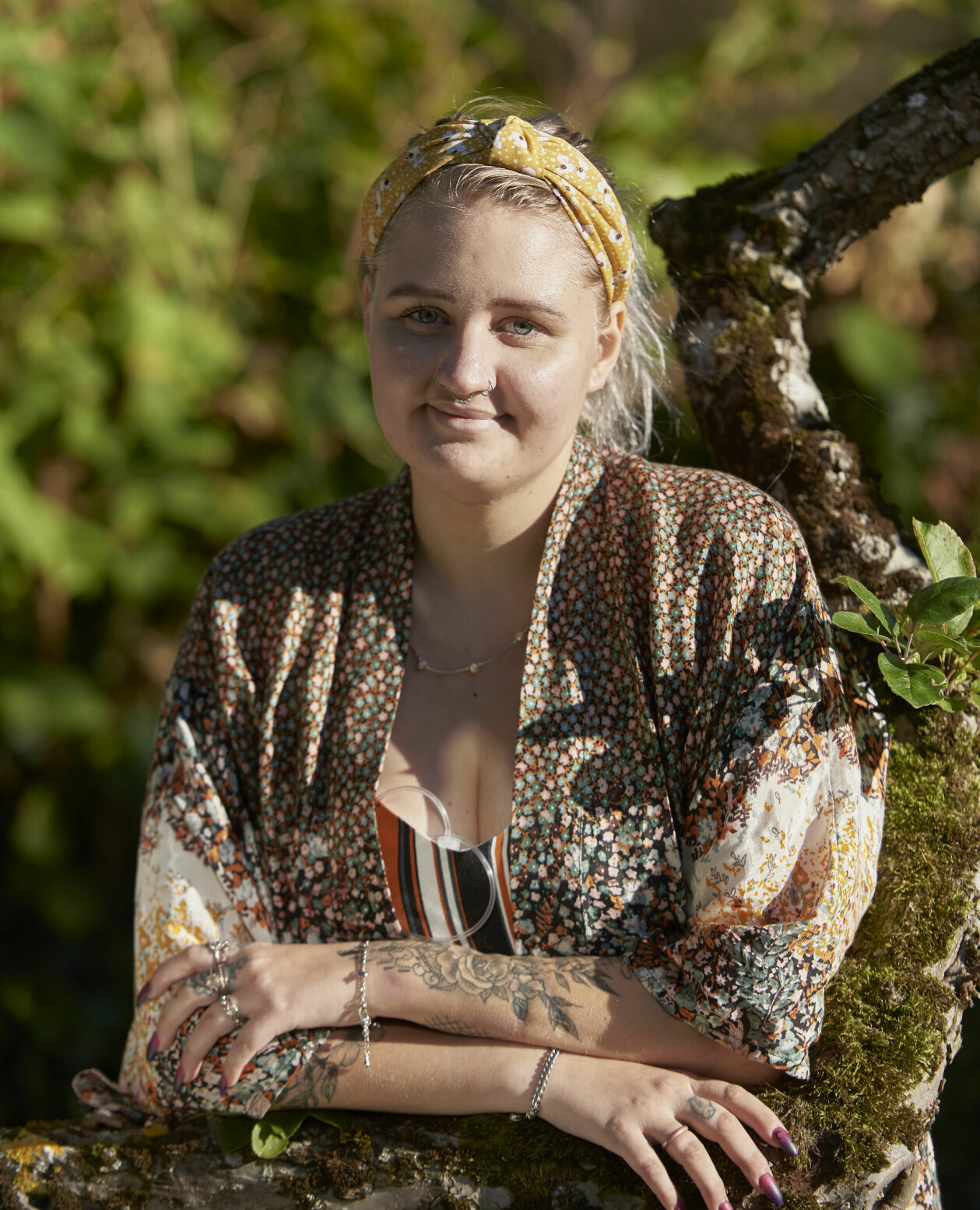 Under en period verkade allt bli bättre, med jobb, resor och vänner. Sedan kom Matildas ångest tillbaka. Matilda Mattsson visar upp sin PICO-pump som hjälper henne läka ett av såren hon fick när hon skadade sig själv.