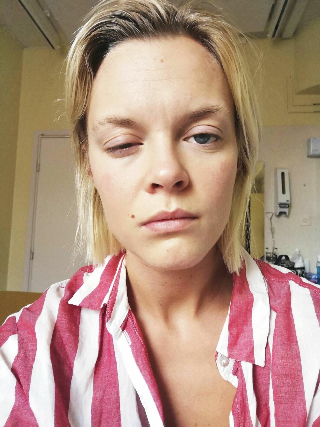 De senaste åren har Matilda haft enorma problem med bland annat smärta, balans och syn. Matilda på sjukhuset med hängigt öga