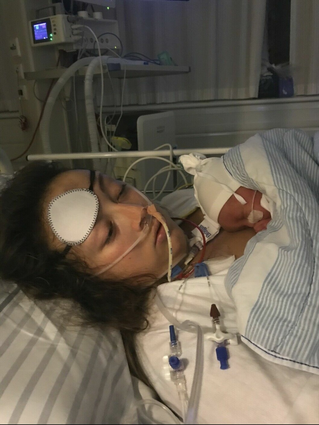 Den 20 oktober 2019, dagen efter Melanies första operation i hjärnstammen. Lilla Nellie är bara ett par dagar gammal. Melanie är medvetslös och ligger med nyfödda Nellie på bröstet.