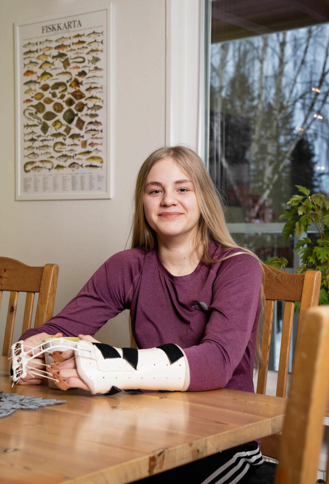 Efter senaste operationen av långfingret och ringfingret har Moa fått en skena att bära så ofta hon orkar för att träna upp fingrarna. Foto: Tobias Nykänen Moa har den ovanliga diagnosen PROS