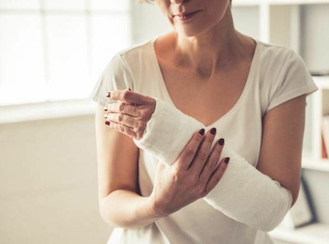 Osteoporos, eller benskörhet, leder ofta till frakturer och benbrott.