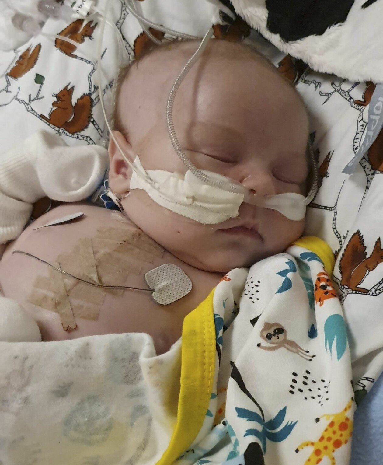 Lille Hugo ligger nedsövd dagen efter hjärtstoppet. Hugo föddes med ett hjärtfel och var nära att dö strax efter födseln. Här ligger han nedsövd dagen efter hjärtstoppet.