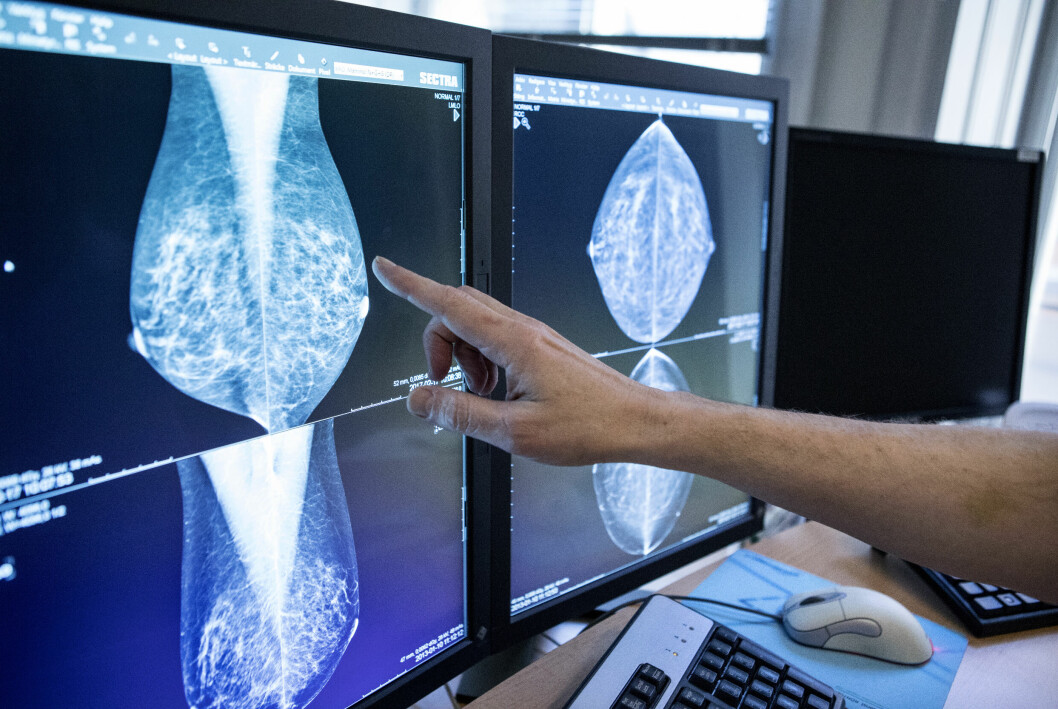 Läkare pekar på mammografibild på datorskärm.
