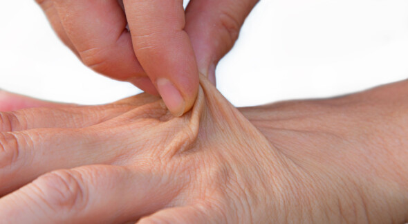 Se la pelle è sul dorso della mano "Alzarsi" Per più di un secondo quando lo pizzichi, mostri segni visibili di secchezza.