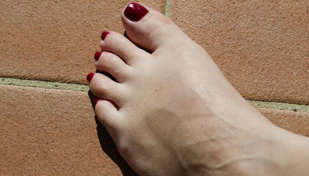 Tips för att slippa svullna fötter i sommarvärmen.