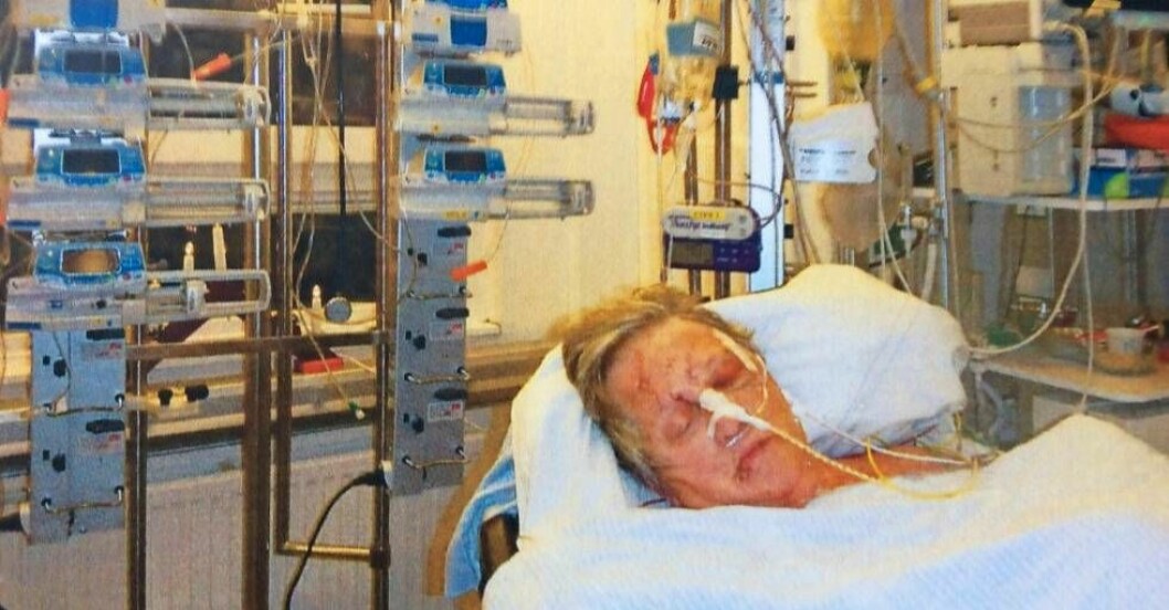 Ulla-Brittas ansikte var mörbultat och skadat av grus och glas och hennes arm söndertrasad. Foto: Privat Ulla-Britta på sjukhuset med hennes ansikte mörbultat och skadat av grus och glas.